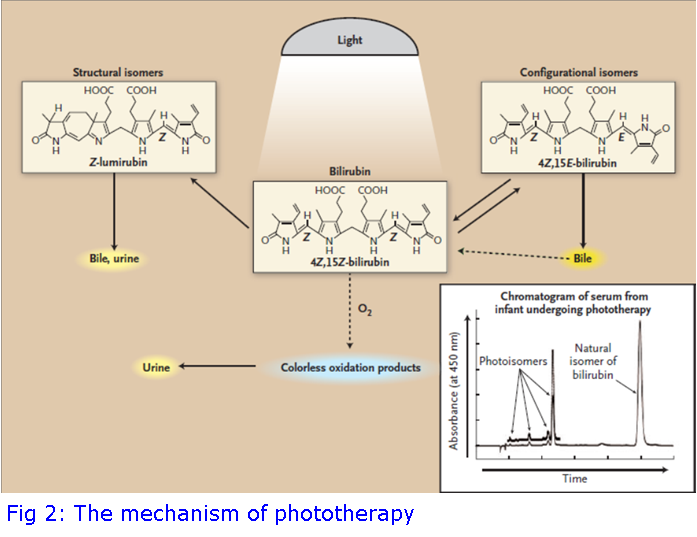 The Birth Of Phototherapy  Synnovis